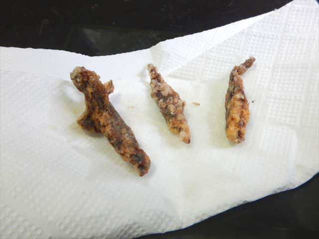 オタマジャクシの四足はチキチキボーンの旨さだった 東京でとって食べる生活